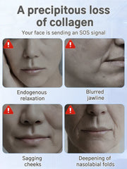 New Upgrade Professional Anti-wrinkle Serum
