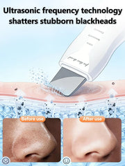 Ultrasonic Skin Scrubber