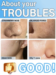 Ultrasonic Skin Scrubber