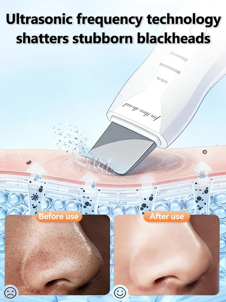 Ultrasonic Skin Scrubber
